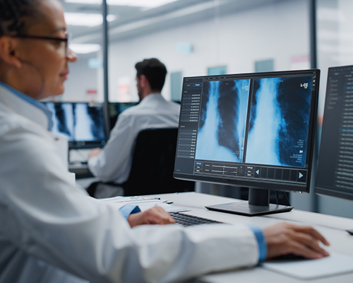 Imaging Lung Imaging Lung