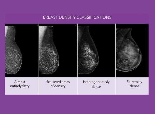 Breast Density Classifications
